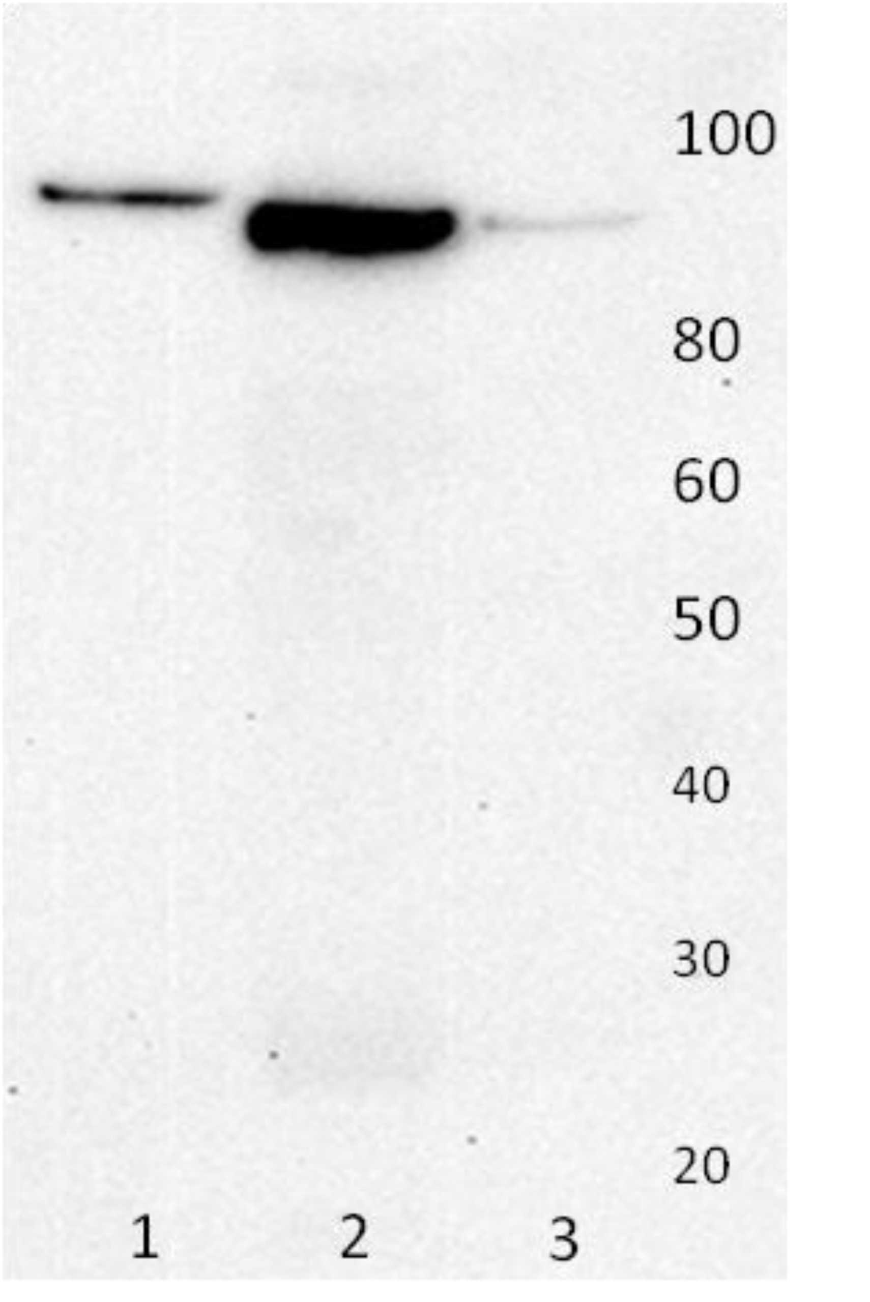 Human Gelsolin Polyclonal Antibody Ampersand Biosciences