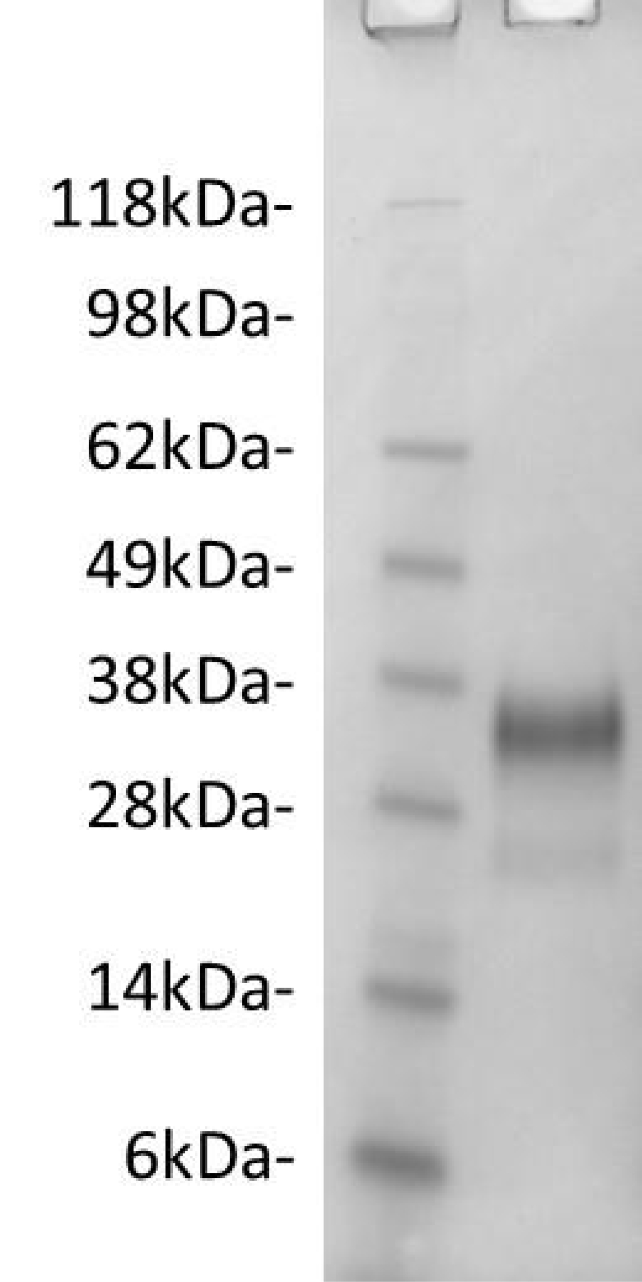 Recombinant Human Gelsolin Protein E Coli Ampersand Biosciences
